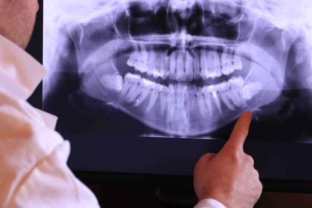 Best Emergency Cosmetic Dentistry in Bermuda Run, NC